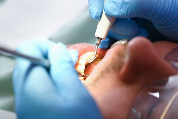 Best Broken or Chipped Tooth Repair in Powell, OH